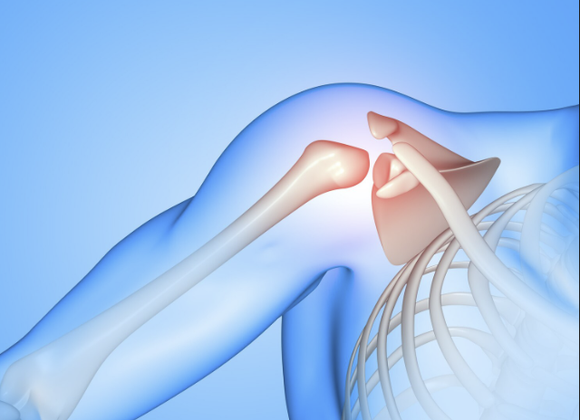 Dolor articular en hombro: causas, síntomas y tratamiento